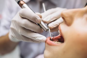 10-despesas-odontologicas_360x240